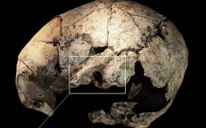 5,300-Year-Old Skull Unearthed In Spanish Tomb Shows Evidence Of Earliest Ear Surgery