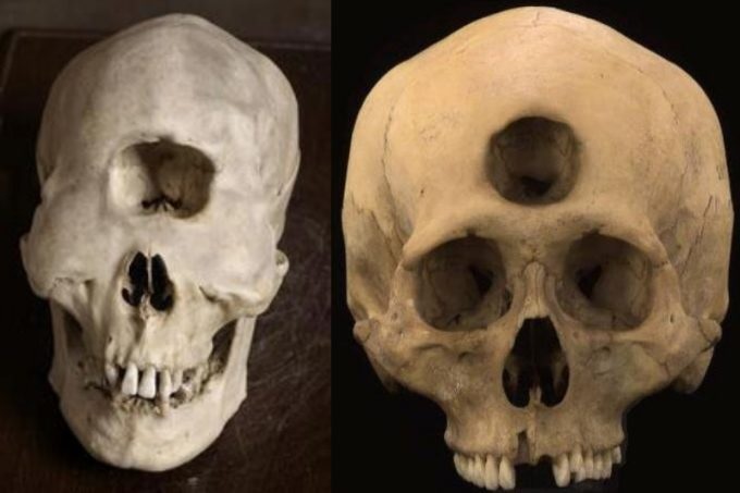 Around the globe, unusual skulls have been discovered.