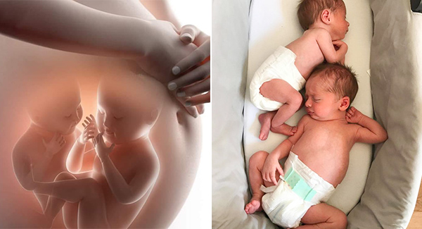 Three weeks after giving birth to twins, the mother became pregnant with twins.