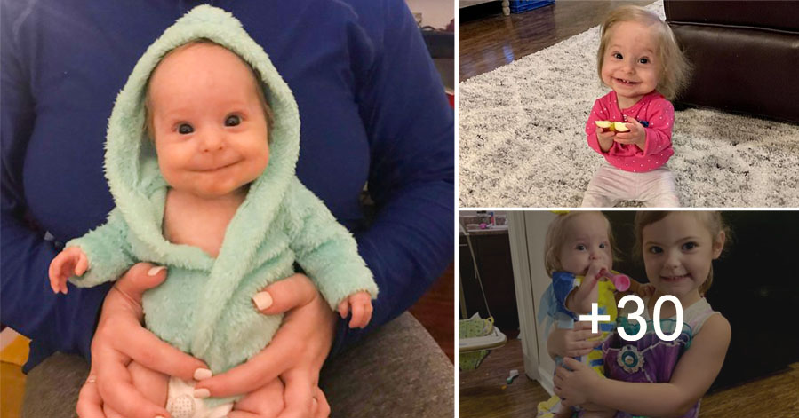 A Two Year Old Girl With A Rare Form Of Dwarfism Wears Infant Sizes 