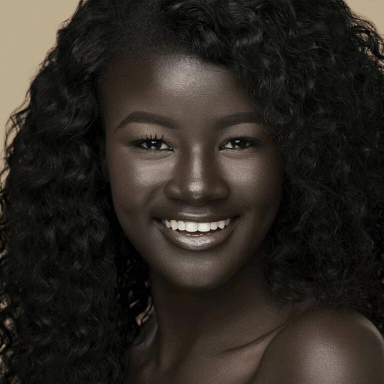 Teen Bullied For Having Exceptionally Dark Skin Color Becomes Model Goes Viral Online