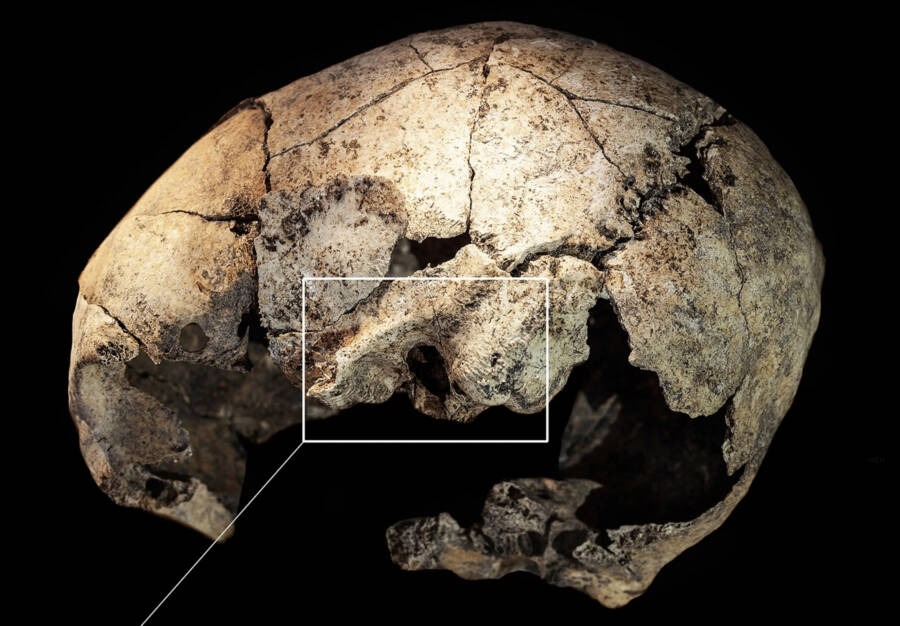 5,300-Year-Old Skull Unearthed In Spanish Tomb Shows Evidence Of Earliest Ear Surgery